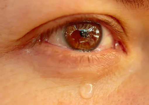 Tear Duct Surgery